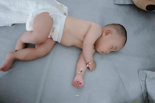 泽州宝宝脸上有白色斑块
